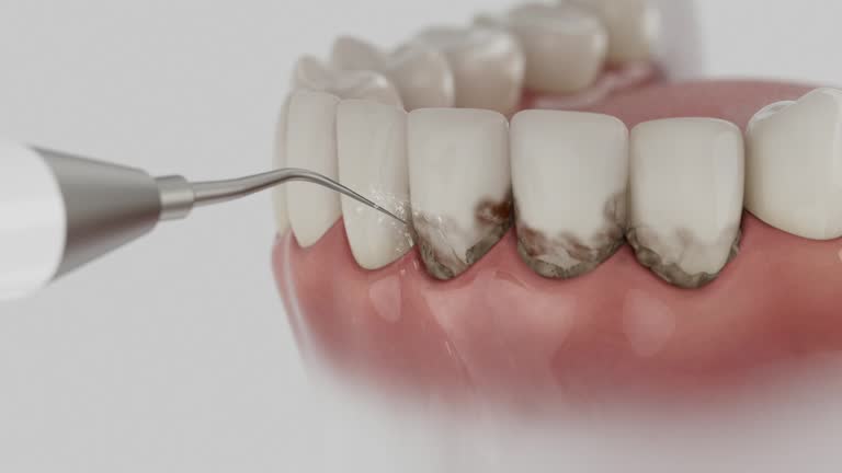Reliable Emergency Dentist contractor in Robinhood, MS by Smile Center Dentistry